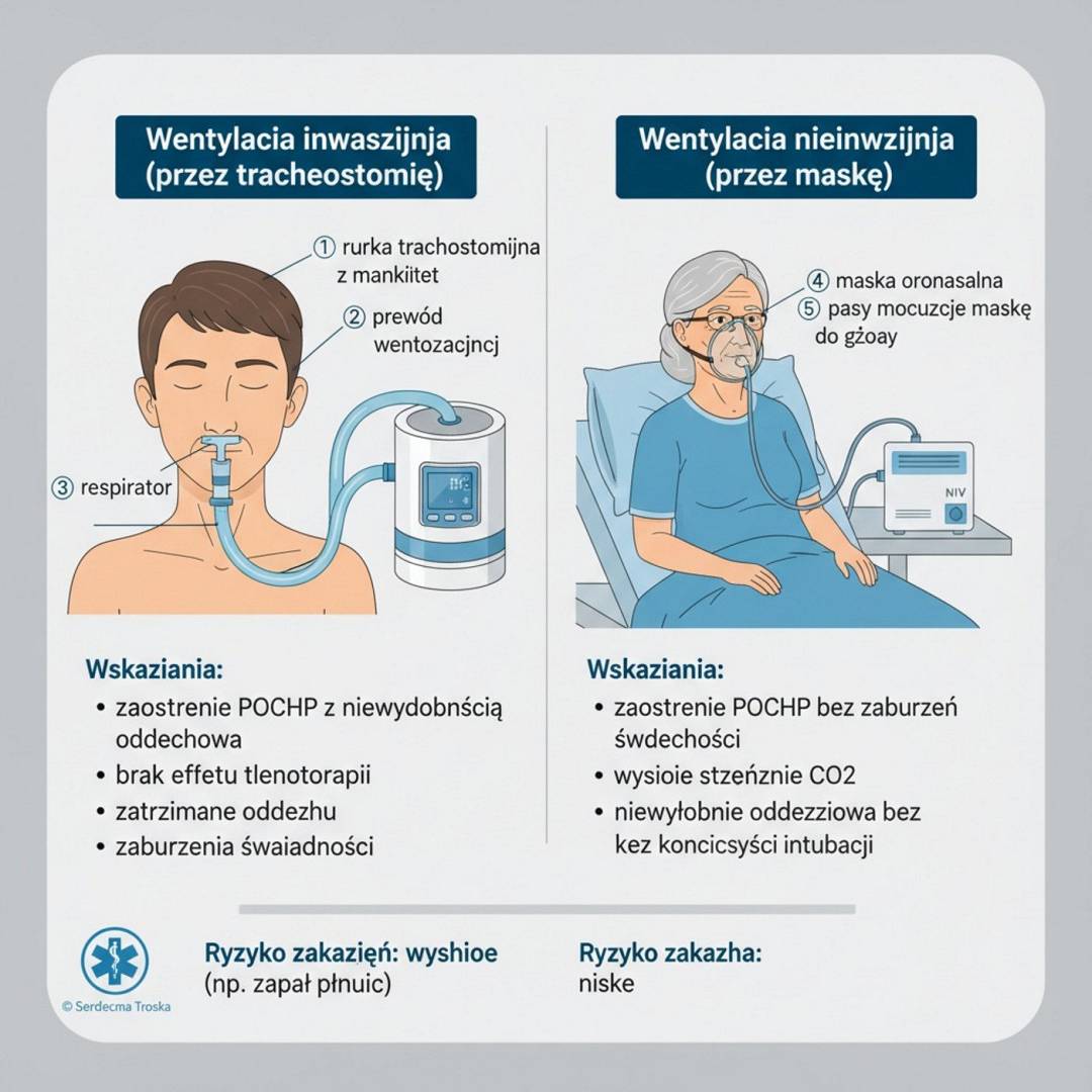 Read more about the article Domowa wentylacja mechaniczna: co wymaga szpitala, a co można prowadzić w domu